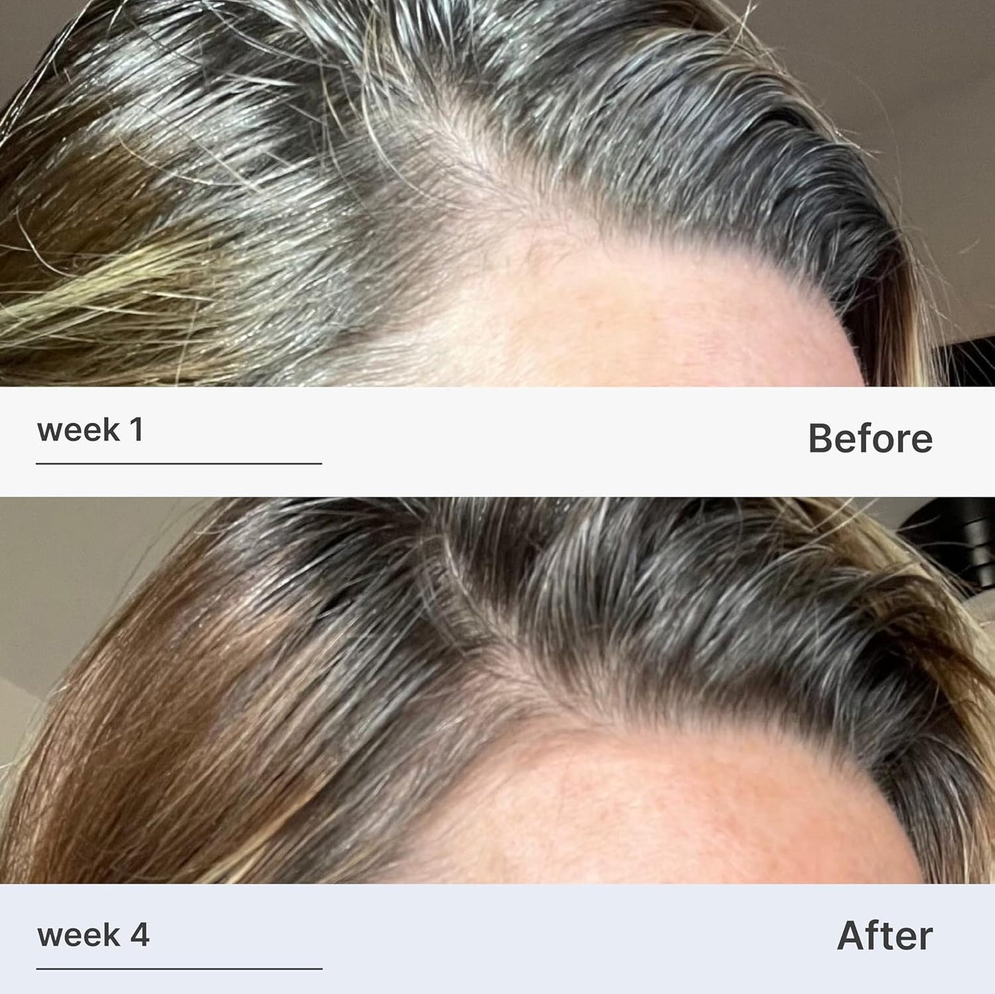 Better Not Younger Fortifying Serum for Thinning and Aging Hair - Promoting Stronger, Thicker Looking Hair Density for Women 40+ Experiencing Hair Loss - 2fl.oz
